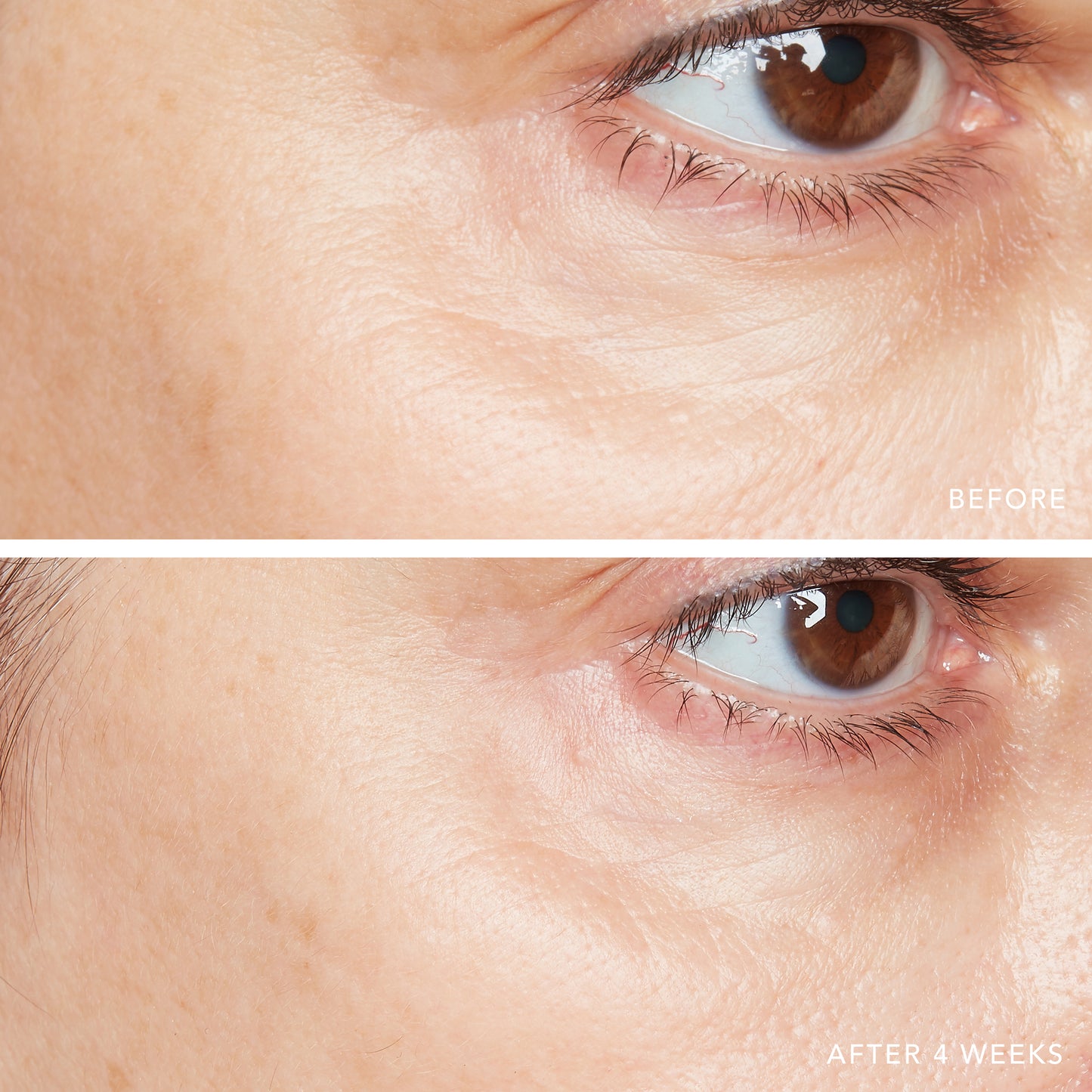 3D Hyaluronic Eye Serum