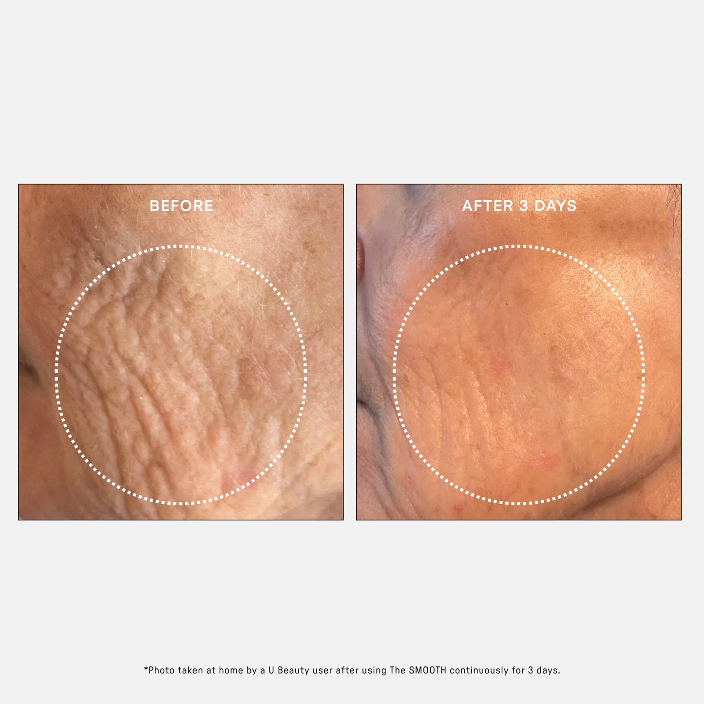 The SMOOTH Dynamic Wrinkle Defense Serum / 15 ml