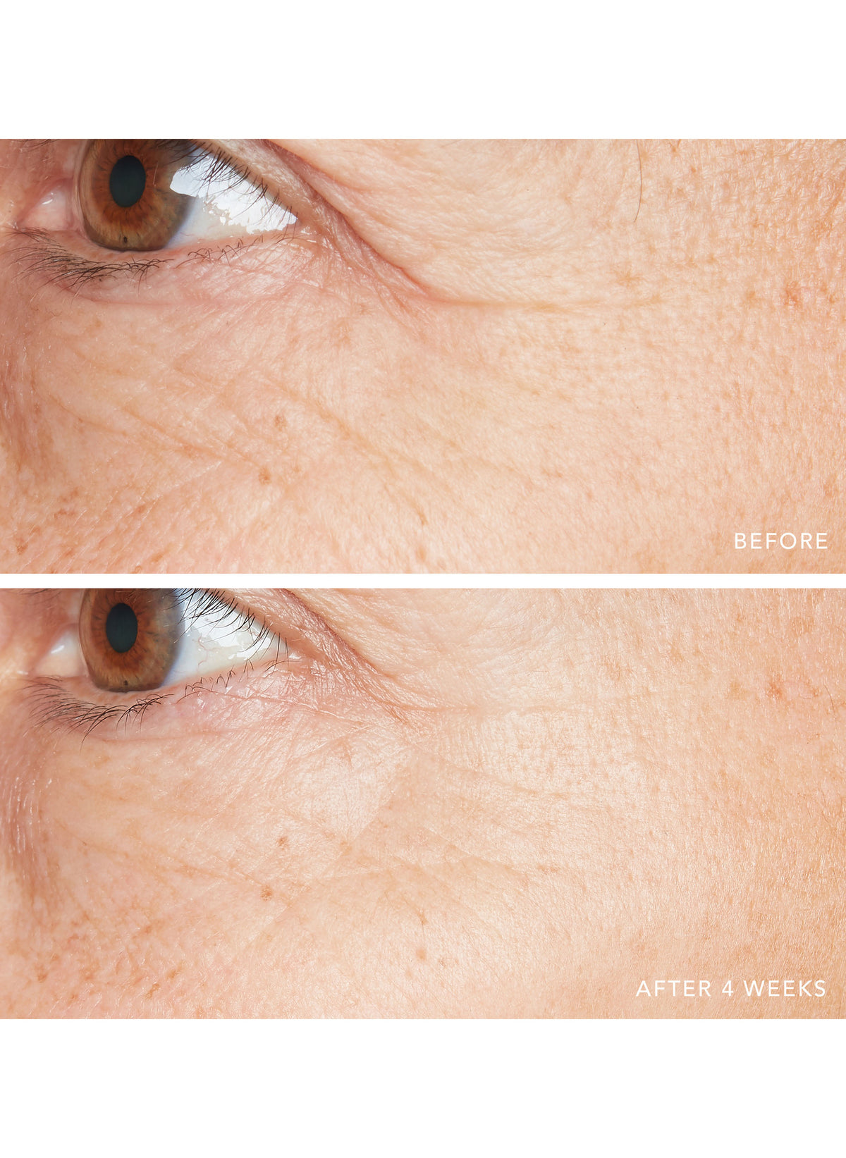 3D Hyaluronic Eye Serum