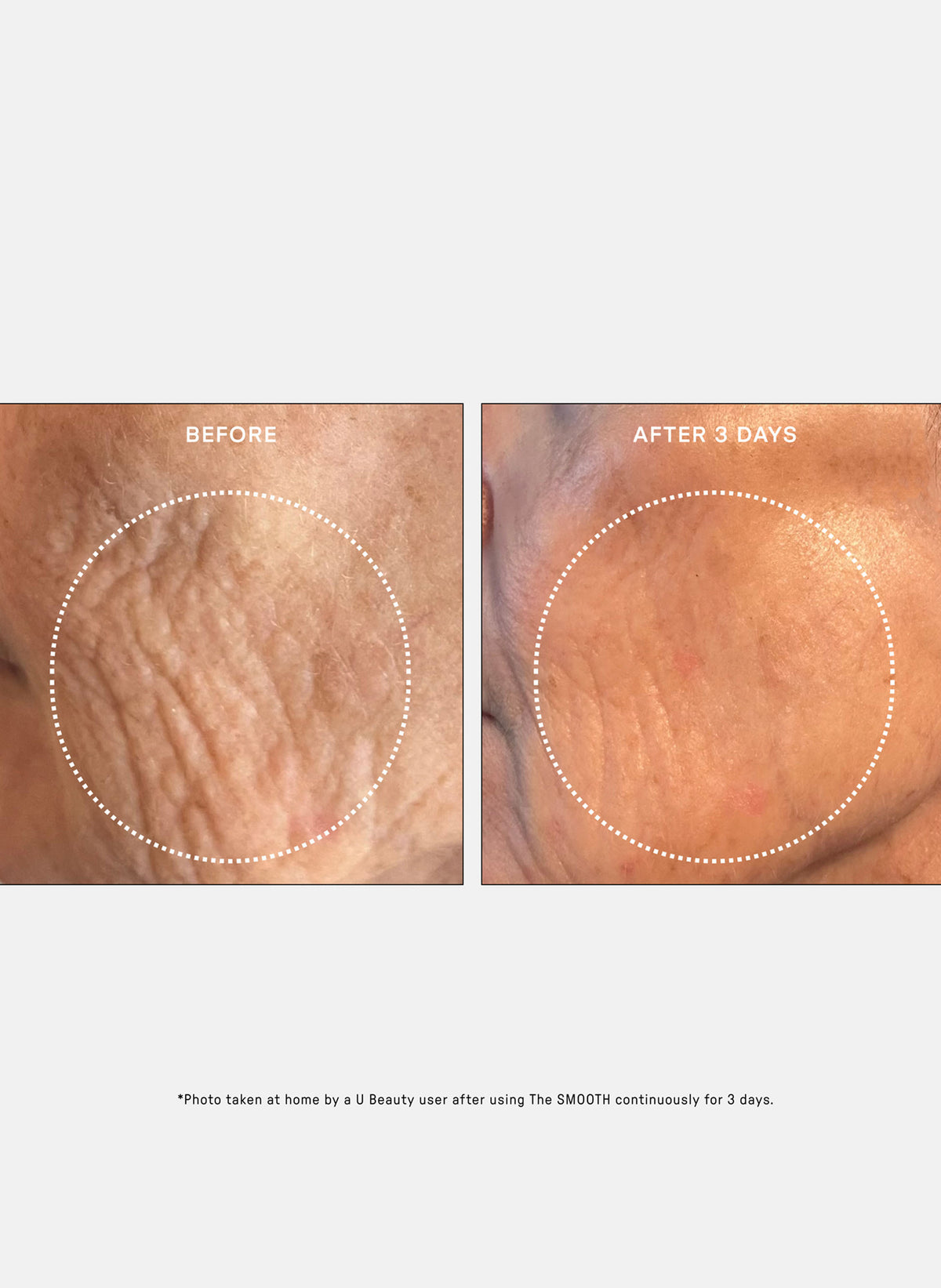 SMOOTH Dynamic Wrinkle Defense Serum / 15 ml