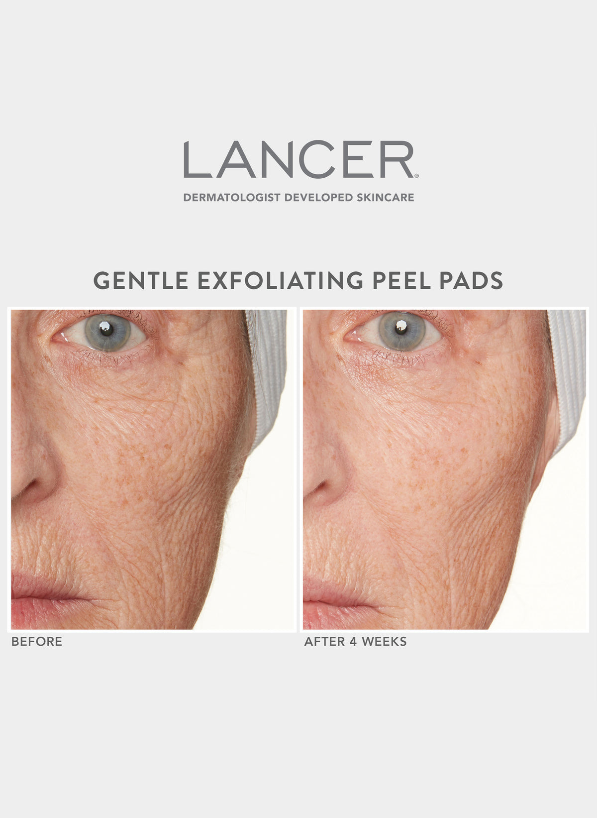 Gentle Exfoliating Peel Pads