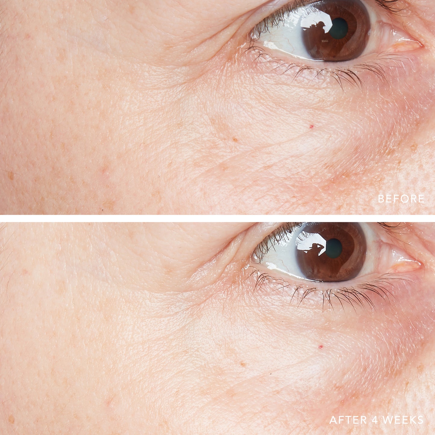 3D Hyaluronic Eye Serum