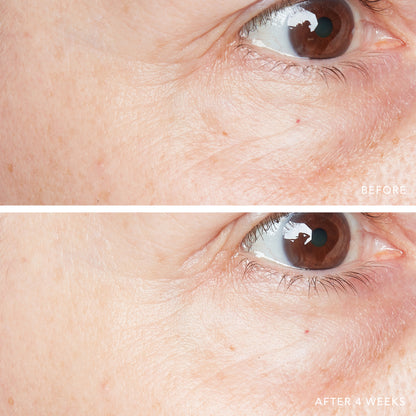 3D Hyaluronic Eye Serum