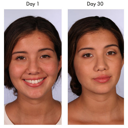 Resurfacing Compound / 15 ml