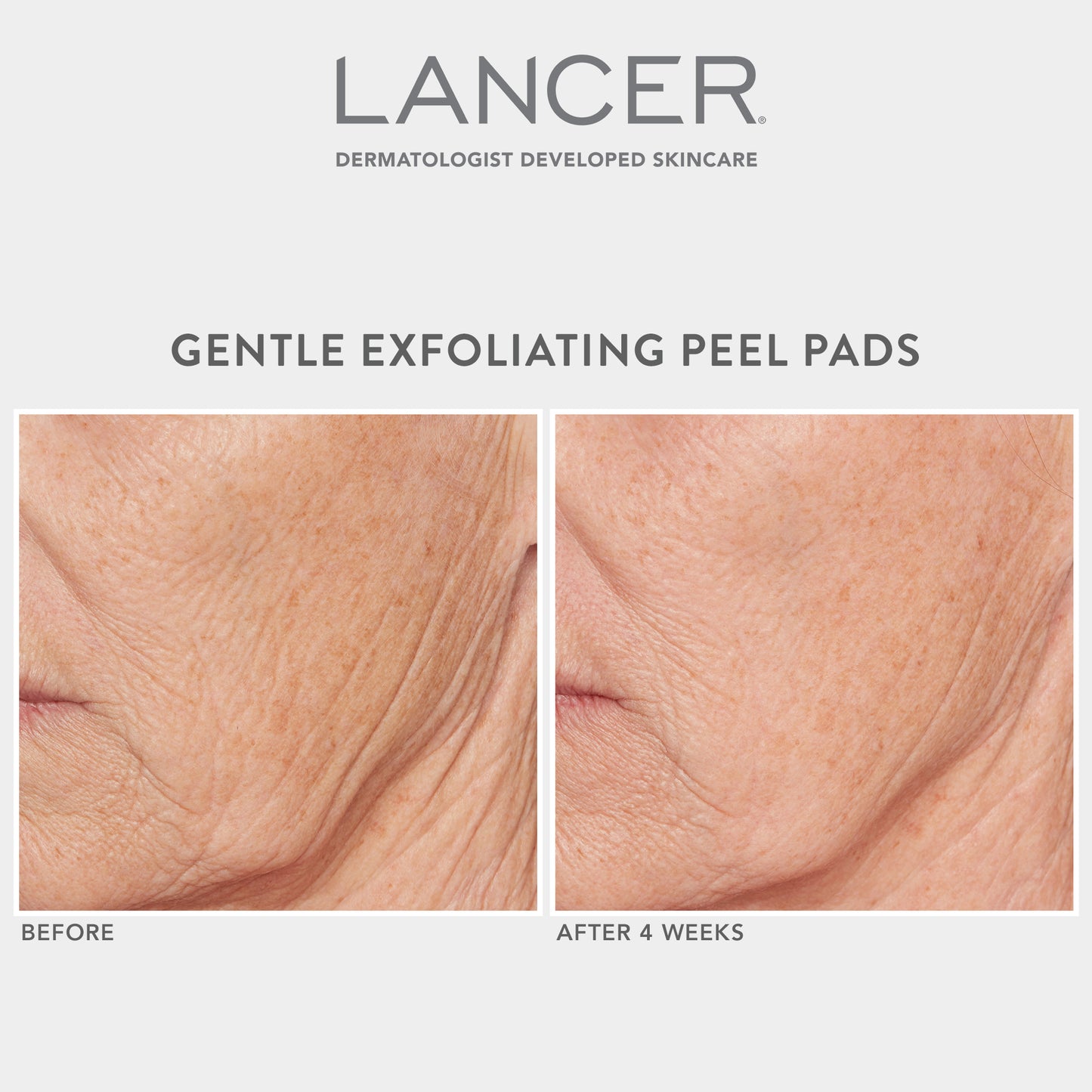 Gentle Exfoliating Peel Pads