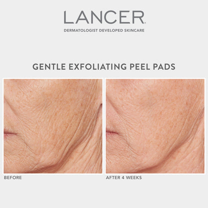 Gentle Exfoliating Peel Pads