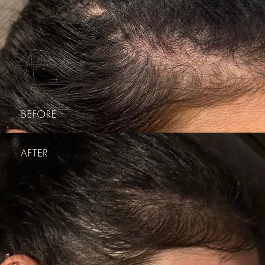 The Hair Serum
