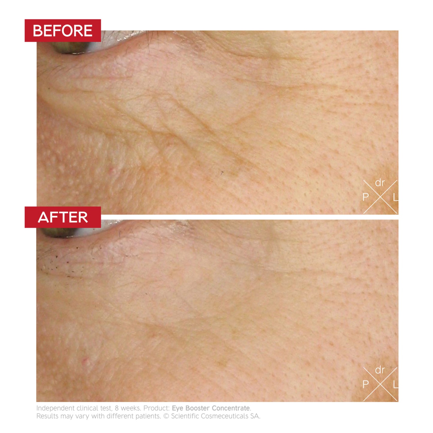 Eye Booster Concentrate / 7 ml