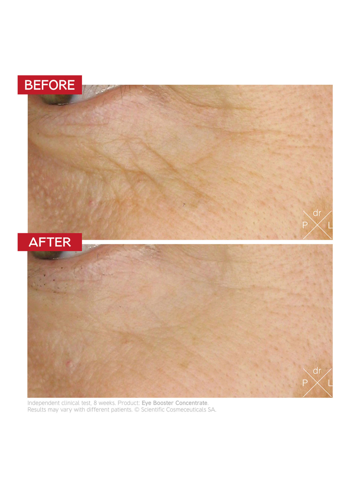 Eye Booster Concentrate / 7 ml