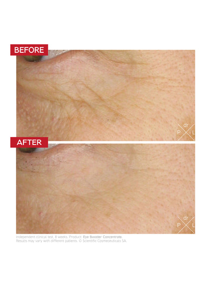 Eye Booster Concentrate / 7 ml