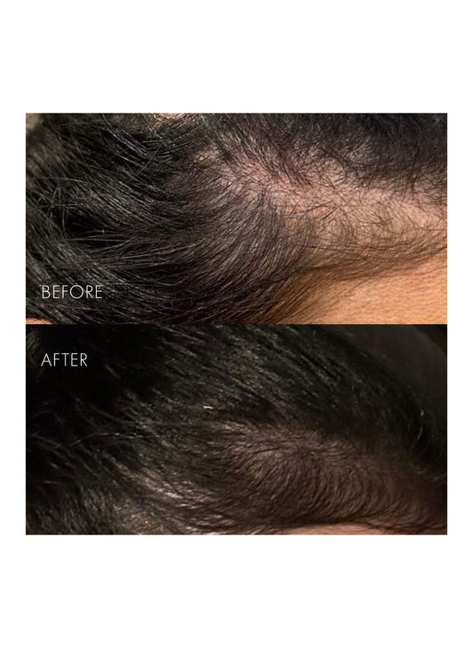 The Hair Serum