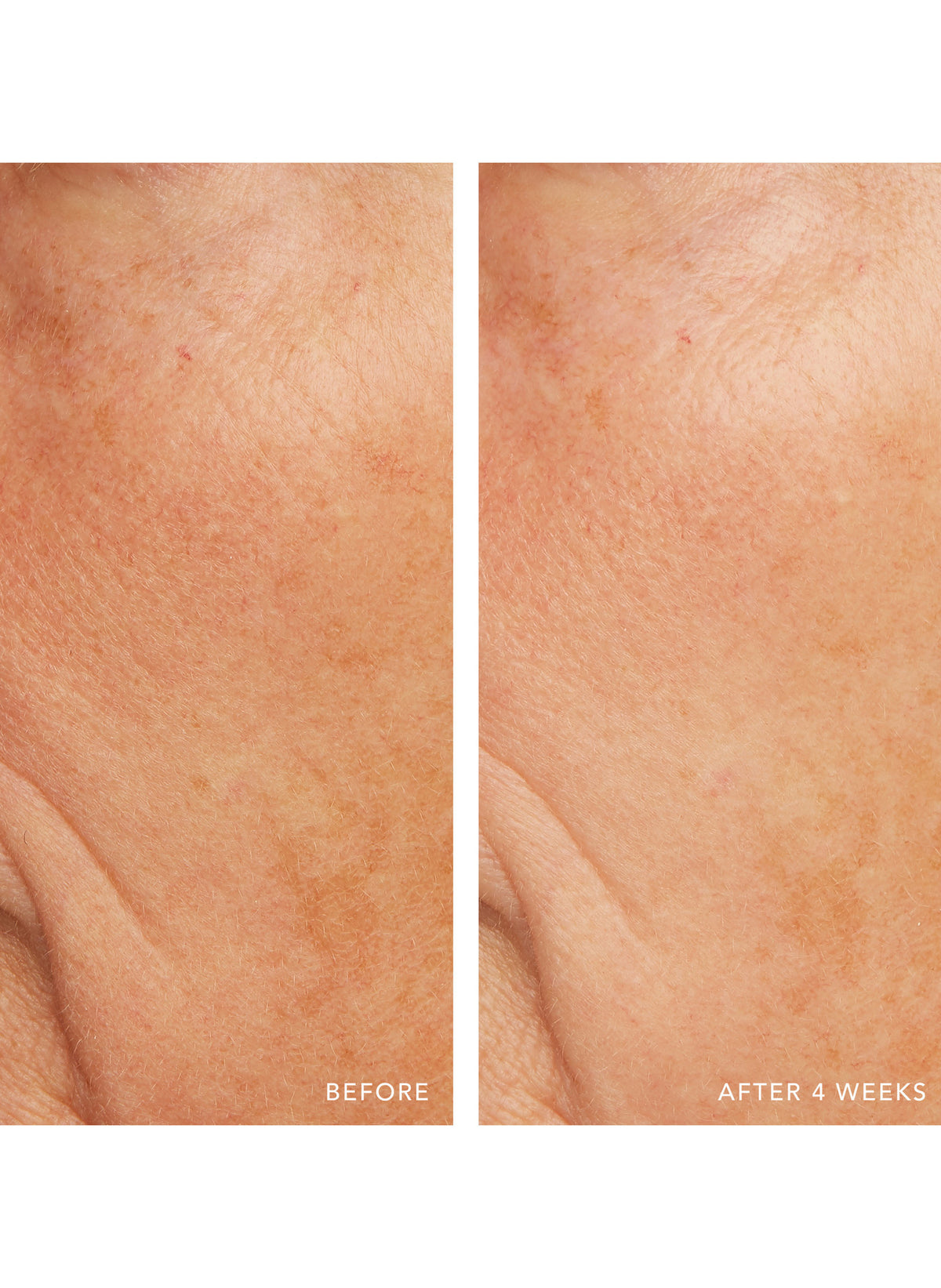 Caviar Lime Acid Peel