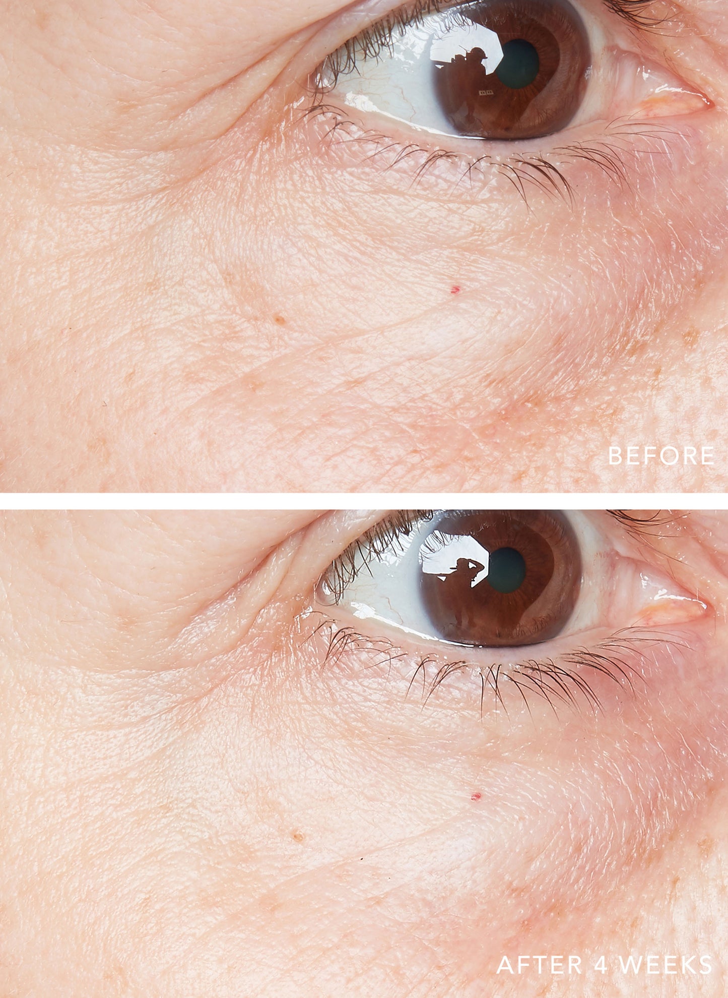 3D Hyaluronic Eye Serum