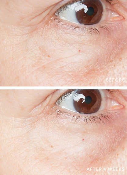3D Hyaluronic Eye Serum