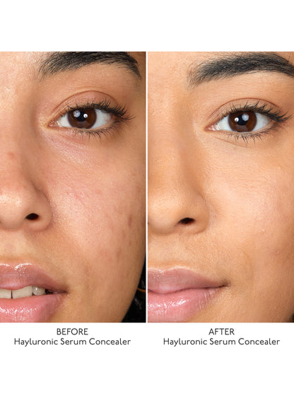 Hyaluronic Serum Concealer / 7. Warm Beige