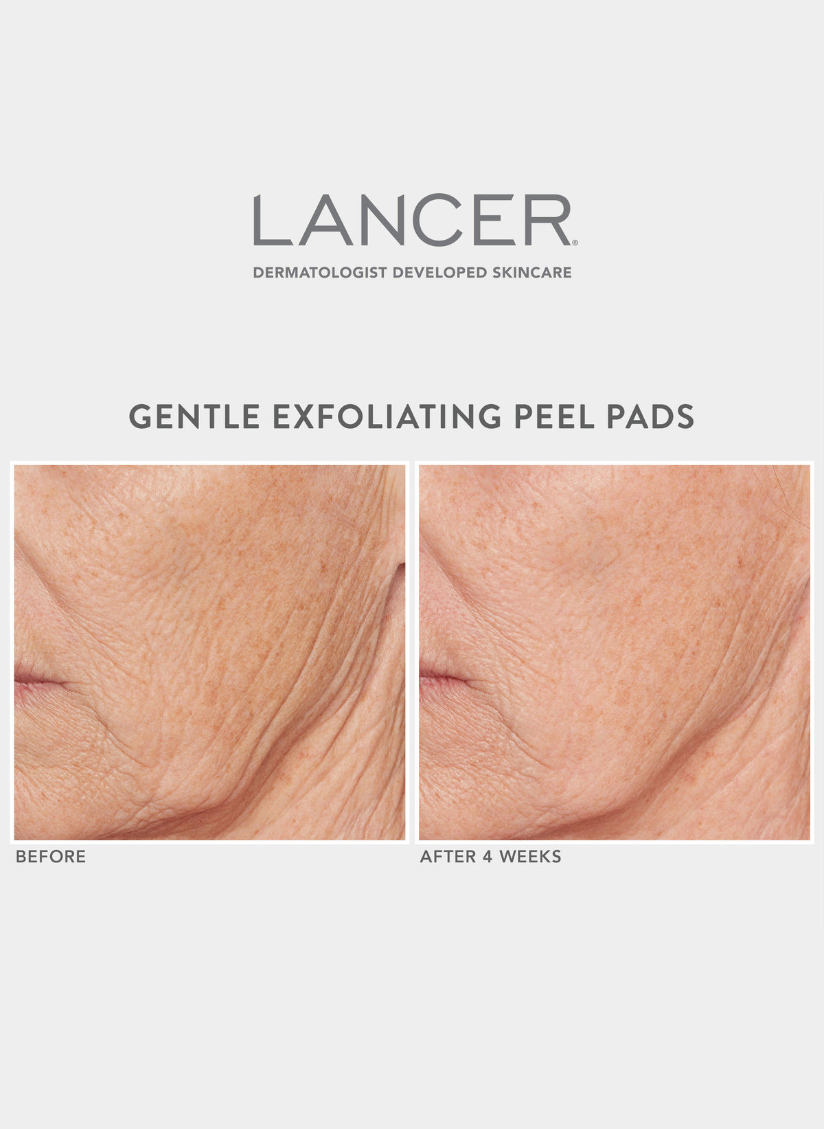 Gentle Exfoliating Peel Pads