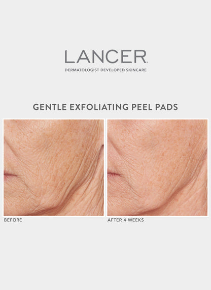 Gentle Exfoliating Peel Pads