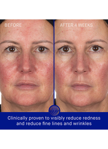 The Hydrogel Face Mask / 1 Stück