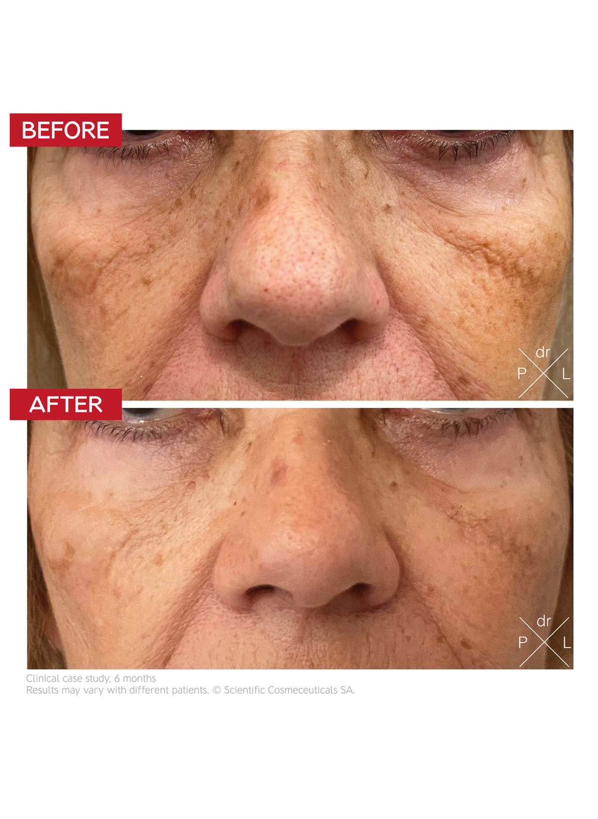 The Eye Longevity Ritual