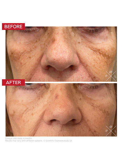 The Eye Longevity Ritual