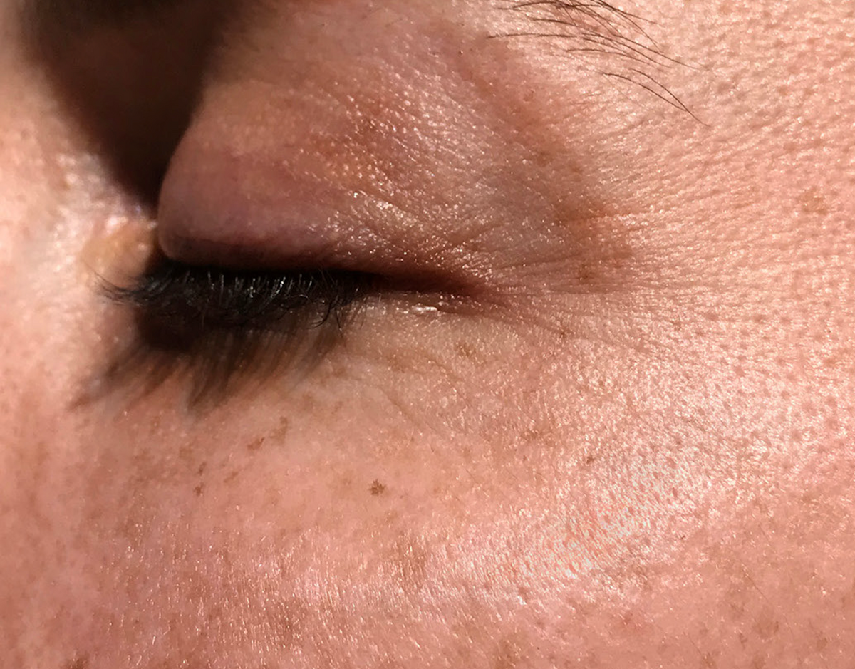 Bye-bye tired-looking eyes